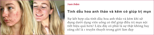 meo-de-kiem-soat-nam-da-trong-mua-he