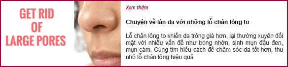 chuyen-ve-lan-da-voi-nhung-lo-chan-long-to