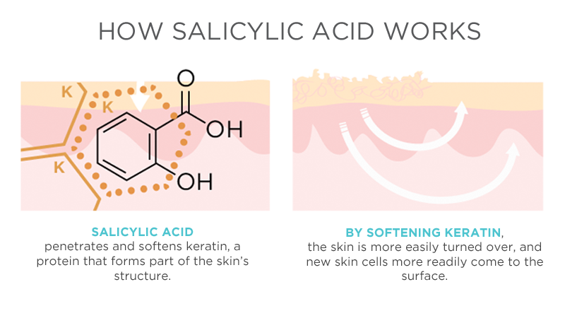 salicylic-acid-va-glycolic-acid-giai-phap-cho-lo-chan-long-bung-bit