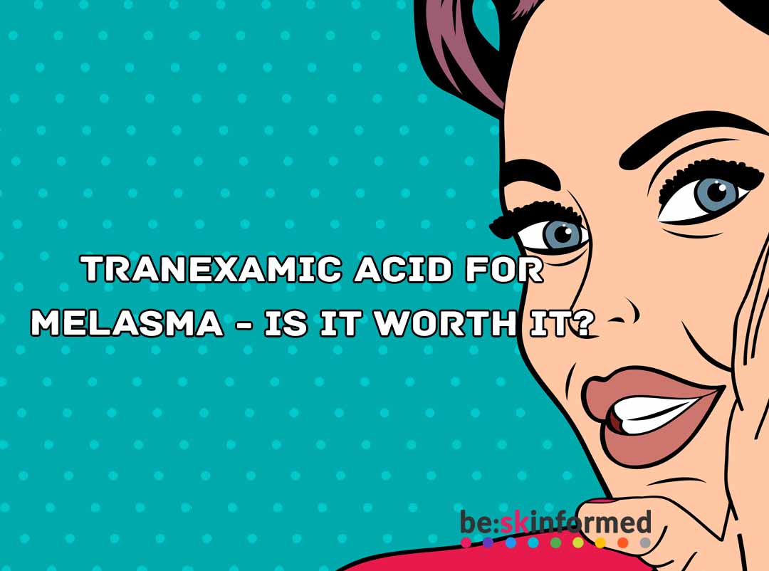 Tranexamic Acid có thật sự hiệu quả trong điều trị nám sạm da không?